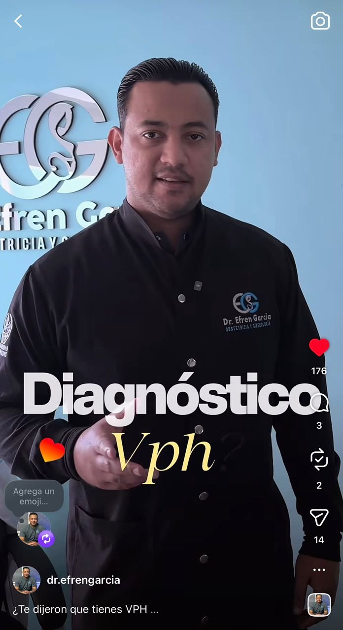 Video Instagram